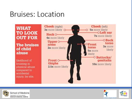 Apr24 Child Abuse webinar.png